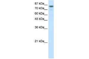 WB Suggested Anti-SMARCA3 Antibody Titration:  2. (HLTF anticorps  (N-Term))