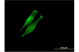 Immunofluorescence of monoclonal antibody to DDOST on HeLa cell.