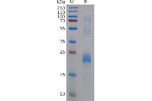 Human CD Protein, N-His Tag on SDS-PAGE under reducing condition.