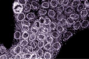 Immunofluorescence staining of A431 cells (Human epithelial carcinoma, ATCC CRL-1555). (NUP88 anticorps  (AA 314-425))