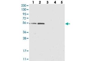 Western blot analysis of Lane 1: RT-4, Lane 2: U-251 MG, Lane 3: Human Plasma, Lane 4: Liver, Lane 5: Tonsil with KCTD20 polyclonal antibody  at 1:250-1:500 dilution. (KCTD20 anticorps)