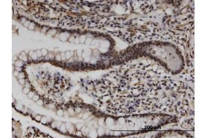 Immunoperoxidase of monoclonal antibody to UPF3A on formalin-fixed paraffin-embedded human small Intestine. (UPF3A anticorps  (AA 274-374))