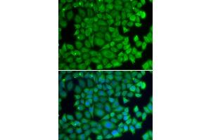 Immunofluorescence analysis of U2OS cells using HSPB2 antibody (ABIN6131082, ABIN6142054, ABIN6142055 and ABIN6219505). (HSPB2 anticorps  (AA 1-182))