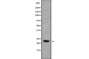 Western blot analysis of RAB1B using COLO205 whole cell lysates