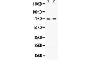 Western blot analysis of ZAP70 expression in JURKAT whole cell lysates ( Lane 1) and CEM whole cell lysates ( Lane 2). (ZAP70 anticorps  (Middle Region))
