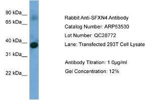 WB Suggested Anti-SFXN4  Antibody Titration: 0. (Sideroflexin 4 anticorps  (N-Term))