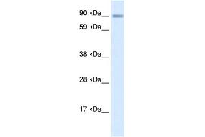 WB Suggested Anti-ZNF537 Antibody Titration:  0. (TSHZ3 anticorps  (Middle Region))