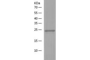 three Prime Repair Exonuclease 2 (Trex2) (AA 1-236) protein (His-IF2DI Tag)