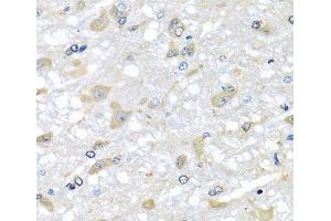 Immunohistochemistry of paraffin-embedded Rat brain using RPLP1 Polyclonal Antibody at dilution of 1:100 (40x lens). (RPLP1 anticorps)