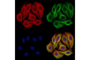 ABIN7094530 and ABIN7098579 staining Hela cells by IF/ICC.