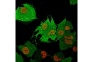 Immunofluorescence Analysis of T98G cells labeling Pgp9.