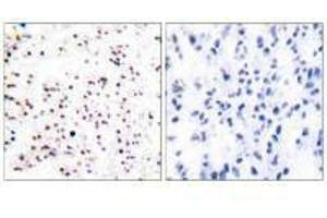 Immunohistochemical analysis of paraffin-embedded human tonsil tissue using MCM5 antibody. (MCM5 anticorps)