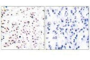 Immunohistochemical analysis of paraffin-embedded human tonsil tissue using MCM5 antibody. (MCM5 anticorps)