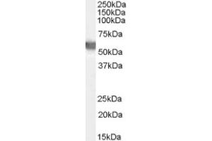Image no. 1 for anti-Glucose-6-Phosphate Dehydrogenase (G6PD) (AA 308-320), (Internal Region) antibody (ABIN374790) (Glucose-6-Phosphate Dehydrogenase anticorps  (Internal Region))
