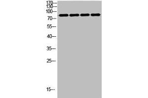 Western Blot analysis of customer's using FOXP1 Antibody Polyclonal Antibody. (FOXP1 anticorps  (C-Term))