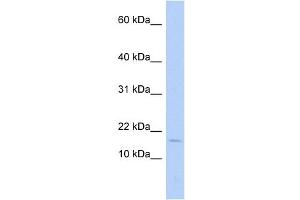 ISCA2 antibody used at 1 ug/ml to detect target protein. (ISCA2 anticorps)