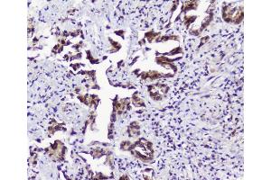 IHC analysis of TPR using anti-TPR antibody (ABIN5693275). (TPR anticorps)