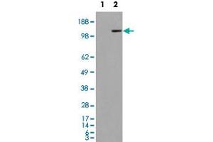 293 overexpressing MAN2A1 and probed with MAN2A1 polyclonal antibody  (mock transfection in first lane), tested by Origene. (alpha-Mannosidase II anticorps  (Internal Region))