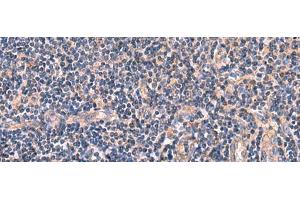 Immunohistochemistry of paraffin-embedded Human tonsil tissue using MYOT Polyclonal Antibody at dilution of 1:65(x200) (Myotilin anticorps)