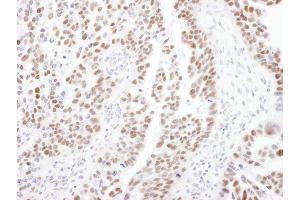 Immunohistochemistry (IHC) image for anti-Protein Phosphatase 4, Regulatory Subunit 2 (PPP4R2) (C-Term) antibody (ABIN7453641)