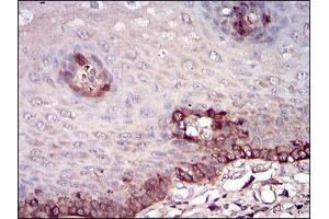 Immunohistochemical analysis of paraffin-embedded esophageal tissues using FTL mouse mAb with DAB staining.