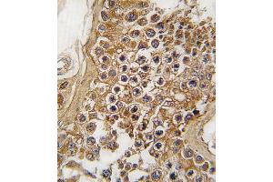 Formalin-fixed and paraffin-embedded human testis tissue reacted with ALK antibody (Center) (ABIN6243477 and ABIN6579002) , which was peroxidase-conjugated to the secondary antibody, followed by DAB staining.
