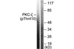 Western blot analysis of extracts from NIH-3T3 cells treated with PMA 125ng/ml 30', using PKC zeta (Phospho-Thr410) Antibody. (PKC zeta anticorps  (pThr410))