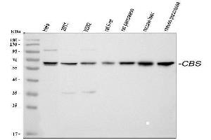 Western blot analysis of CBS using anti-CBS antibody (ABIN3043747). (CBS anticorps  (AA 331-551))