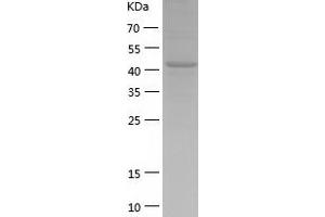 Western Blotting (WB) image for Cbl Proto-Oncogene B, E3 Ubiquitin Protein Ligase (CBLB) (AA 39-426) protein (His-IF2DI Tag) (ABIN7122186)