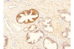 Immunohistochemistry (IHC) image for anti-Growth Arrest and DNA-Damage-Inducible, beta (GADD45B) (Middle Region) antibody (ABIN2783334)