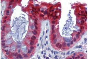 Human Colon (formalin-fixed, paraffin-embedded) stained with CASP7 antibody ABIN462357 followed by biotinylated anti-mouse IgG secondary antibody ABIN481714, alkaline phosphatase-streptavidin and chromogen. (Caspase 7 anticorps)