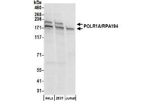 anti-Polymerase (RNA) I Polypeptide A, 194kDa (POLR1A) (AA 1425-1475) antibody