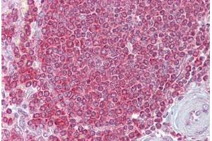 Anti-RPSA / Laminin Receptor antibody IHC staining of human spleen.