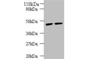Western blot All lanes: KRT18 antibody at 2 μg/mL Lane 1: K562 whole cell lysate Lane 2: HepG2 whole cell lysate Secondary Goat polyclonal to rabbit IgG at 1/10000 dilution Predicted band size: 49 kDa Observed band size: 49 kDa