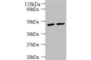 Western blot All lanes: KRT18 antibody at 2 μg/mL Lane 1: K562 whole cell lysate Lane 2: HepG2 whole cell lysate Secondary Goat polyclonal to rabbit IgG at 1/10000 dilution Predicted band size: 49 kDa Observed band size: 49 kDa (Cytokeratin 18 anticorps  (AA 102-396))
