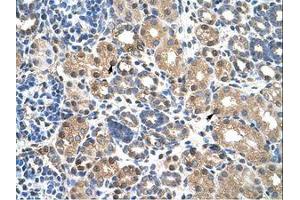 Image no. 1 for anti-Pre-B-Cell Leukemia Transcription Factor 3 (PBX3) (N-Term) antibody (ABIN203364)