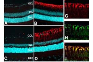Localization of glutamine synthase in the retina. (GLN1 anticorps)
