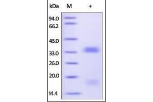 SDS-PAGE (SDS) image for Vascular Endothelial Growth Factor B (VEGFB) (AA 22-207) (Active) protein (His tag) (ABIN2181909)