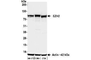 Western Blotting (WB) image for anti-Enhancer of Zeste Homolog 2 (EZH2) (AA 1-154) antibody (ABIN7795766) (Recombinant EZH2 anticorps  (AA 1-154))