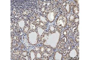 IHC analysis of CTBP2 using anti-CTBP2 antibody (ABIN7601326). (CTBP2 anticorps  (AA 321-445))