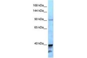 Image no. 1 for anti-Kinesin Family Member 7 (KIF7) (AA 1224-1273) antibody (ABIN6747946) (KIF7 anticorps  (AA 1224-1273))