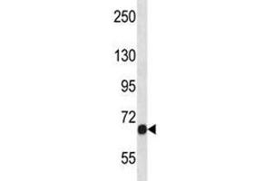 Fgfr1 antibody western blot analysis in NCI-H460 lysate.