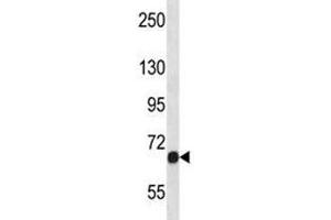 Fgfr1 antibody western blot analysis in NCI-H460 lysate. (FGFR1 anticorps  (AA 756-784))