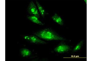 Immunofluorescence of monoclonal antibody to PSMC4 on HepG2 cell.