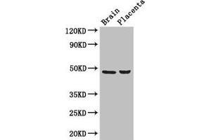 Western Blot Positive WB detected in: Mouse brain tissue, Human placenta tissue All lanes: CD177 antibody at 3 μg/mL Secondary Goat polyclonal to rabbit IgG at 1/50000 dilution Predicted band size: 47, 28, 16 kDa Observed band size: 47 kDa
