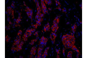 Immunofluorescence (IF) image for anti-Cytoskeleton-Associated Protein 4 (CKAP4) (AA 500-550) antibody (ABIN7448940)