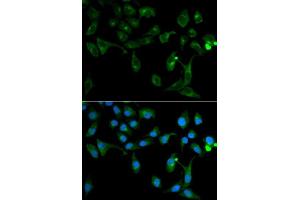 Immunofluorescence analysis of U2OS cells using TOLLIP antibody. (TOLLIP anticorps  (AA 1-274))