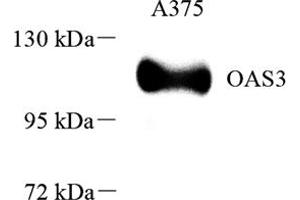 Western blot analysis of OAS3 (ABIN7072846),at dilution of 1: 1000 (OAS3 anticorps)