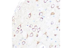 Immunohistochemistry of paraffin-embedded rat brain using MSR1 Rabbit mAb (ABIN7268353) at dilution of 1:100 (40x lens).