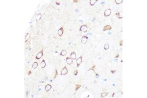 Immunohistochemistry of paraffin-embedded rat brain using MSR1 Rabbit mAb (ABIN7268353) at dilution of 1:100 (40x lens). (Macrophage Scavenger Receptor 1 anticorps)